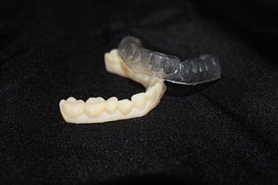 Esecuzione di vassoi ortodontici 
