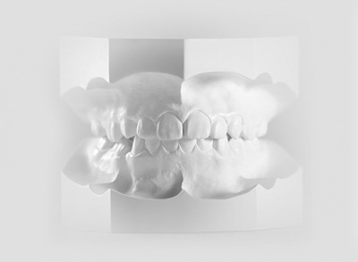 Esecuzione modelli studio ortodontico 