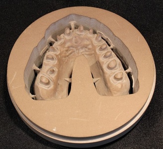 Esecuzione del modello dentale 